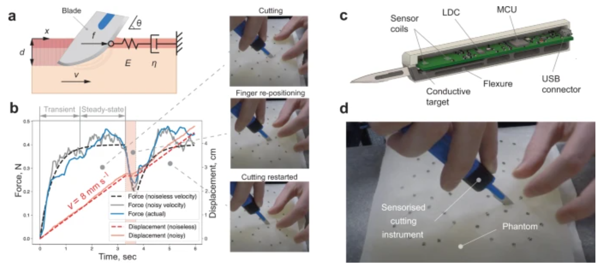 Generative Force Model Surgery Generative Force Model for Surgery